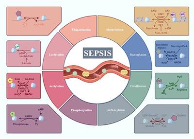 Post-translational modifications in sepsis-induced organ dysfunction: mechanisms and implications